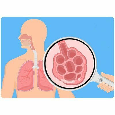 Asthma with Homeopathic medicines_www.bharathomeopathy.com