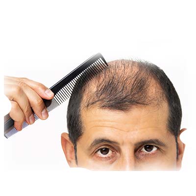 Homeopathy is important for curing hair fall_www.bharathomeopathy.com