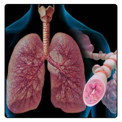 Habits to Avoid Asthma Attacks