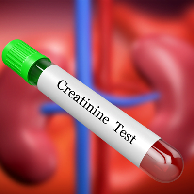 Creatinine test